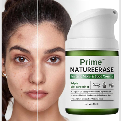 Prime® NatureErase Instant Mole & Spot Cream